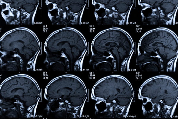 多张脑部扫描图