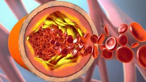 血液细胞在动脉中流动的插图
