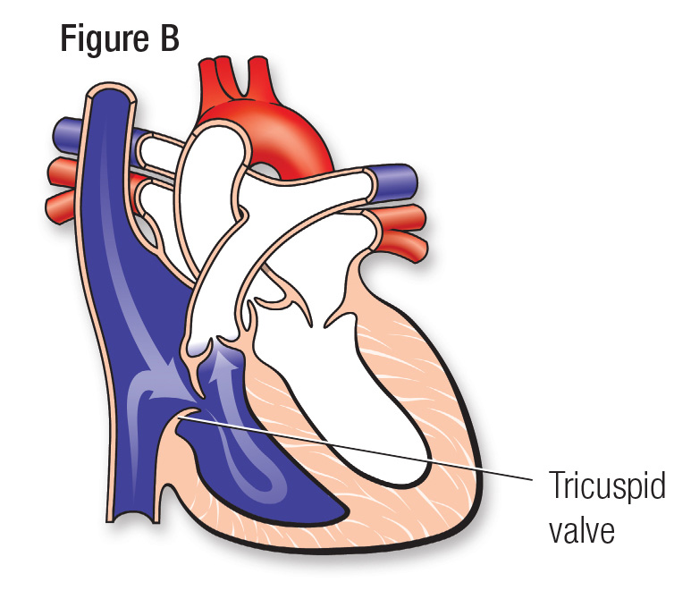 心脏正常图B